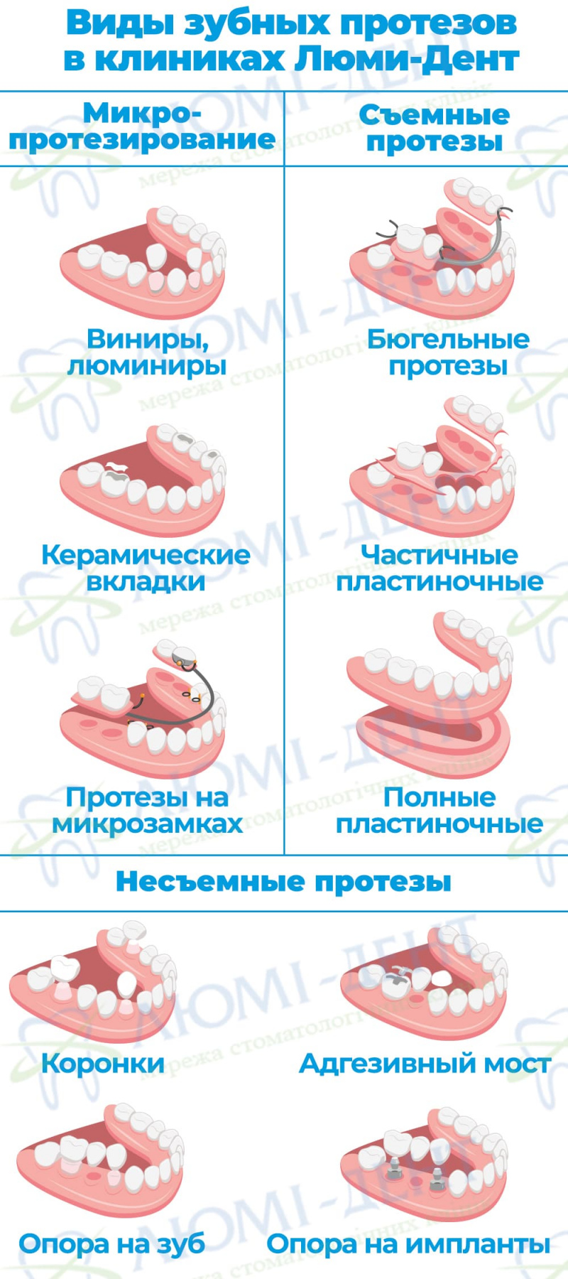 Зубные протезы фото Люми-Дент