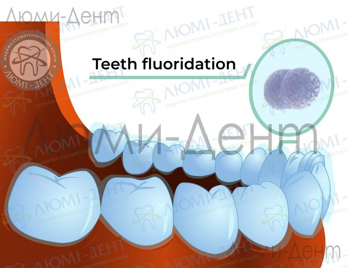 Remineralization of teeth