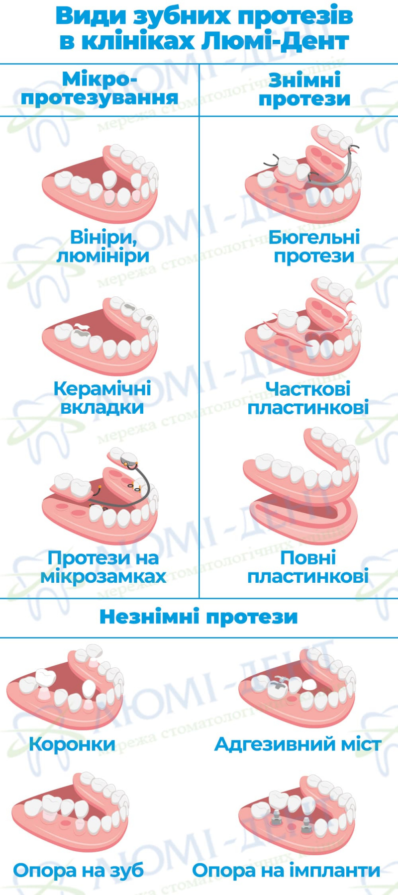 Знімні зубні протези фото Люмі-Дент