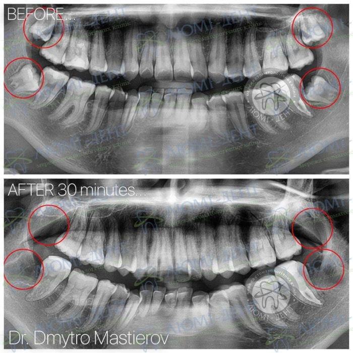 Хирургическая стоматология фото киев Люми-Дент