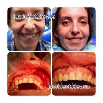 хірургічна стоматологія
